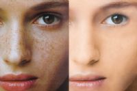 美容院的祛斑项目可靠吗