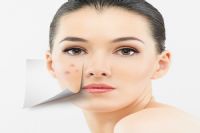 怎么快速祛痘？来看看最给力的“灭痘”大法