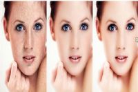 涨知识 消除脸上色斑只需这样