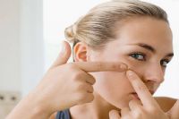 美容师为您分析为何脸上痘痘不断