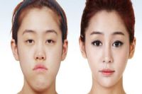 那些坏习惯加速了你的衰老