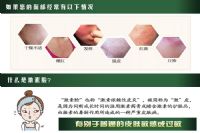 怎么看护肤品有没有添加激素 检测有方法