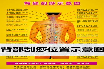 背部刮痧从颈椎到腰椎位置示意图大全