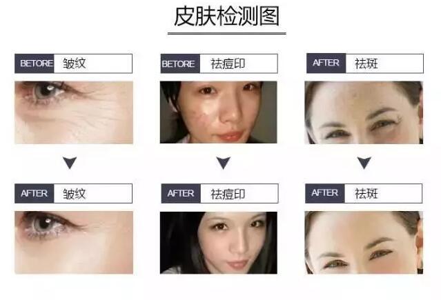 皮肤检测